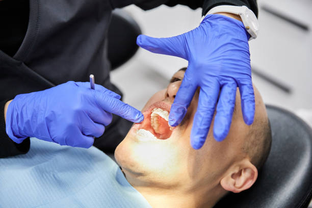 Best Emergency Wisdom Teeth Removal in Stallion Springs, CA